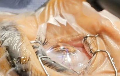 Görme Bozukluklarının Tedavisinde Lasik Ameliyatı