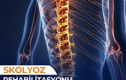 Skolyoz Tedavisinde Erken Tanı ve Uygulamaların Önemi