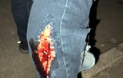 Başıboş Köpek Saldırısı Sonrası Mahallede Büyük Endişe